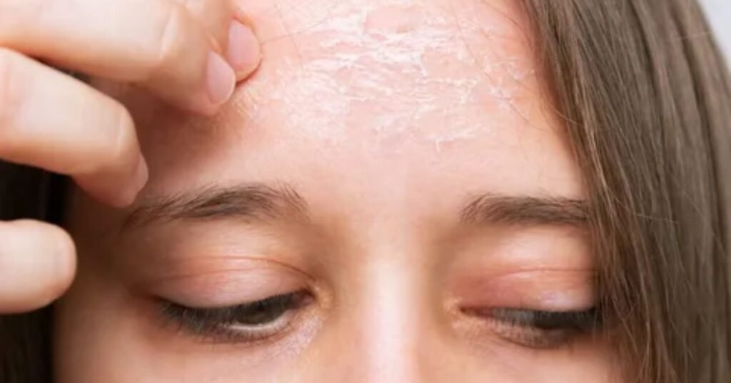 Best Hand Moisturizer for Dry Skin